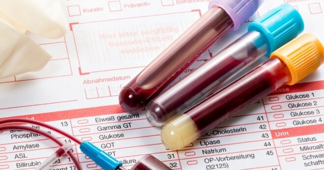 Тест крви за хумани папилома вирус